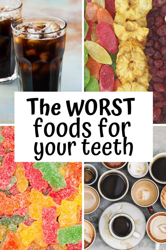 Foods Most Likely to Cause Tooth Decay